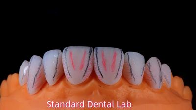 Standard Dental Lab Co., Limited dây chuyền sản xuất của nhà sản xuất