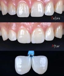 Standard Dental Lab Co., Limited dây chuyền sản xuất của nhà sản xuất