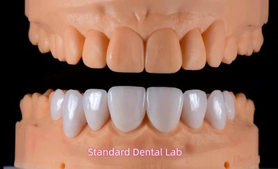 Standard Dental Lab Co., Limited dây chuyền sản xuất của nhà sản xuất
