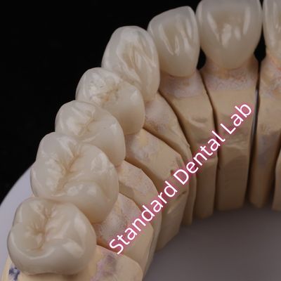 Mua Digital CAD CAM Phòng thí nghiệm nha khoa PFZ Vương miện xuyên suốt Lớp vương miện Zirconia sản xuất trực tuyến