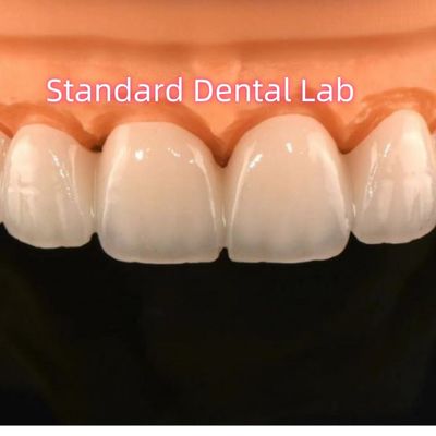 Mua Phòng thí nghiệm nha khoa cây cầu vương miện Zirconia với đồ sứ lớp sản xuất trực tuyến
