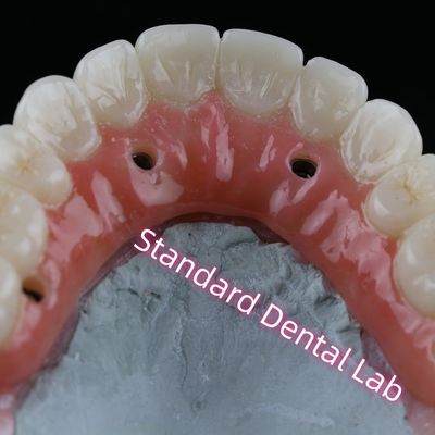Mua Vương miện cấy ghép răng PFZ Vòng vít Zirconia lớp sứ được giữ lại với kẹo cao su màu hồng sản xuất trực tuyến