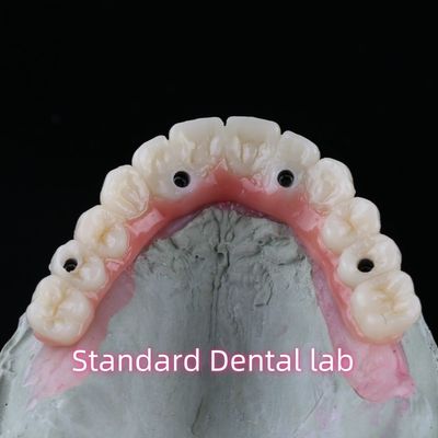 Mua Porcelain Zirconia Dental Implant Bridge chuyên nghiệp thẩm mỹ cao với kẹo cao su sản xuất trực tuyến