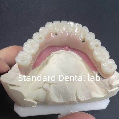 Mua Phục hồi thẩm mỹ Tất cả trên 4 cấy ghép răng Zirconia Hypo Allergenic sản xuất trực tuyến