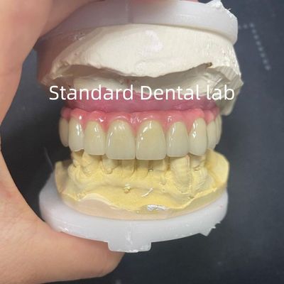 Mua Malo Bridge Hybrid Zirconia All On Four / Six Zirconia Implant Bridge Ti-tan Bar sản xuất trực tuyến