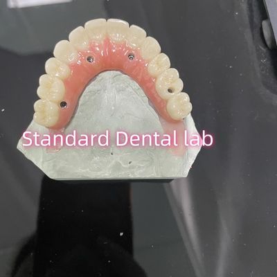 Mua Tất cả trên bốn sáu Ivoclar Zirconia cấy ghép cây cầu Ti-tan thanh với cao su pinh sản xuất trực tuyến