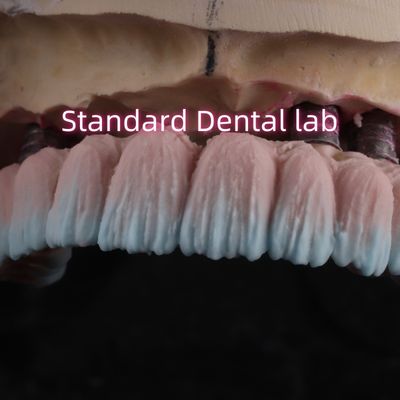 Mua Vòng vít cây cầu cấy ghép Zirconia được giữ bằng đồ sứ cao su màu hồng sản xuất trực tuyến