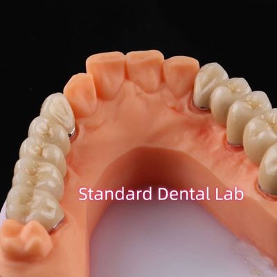 Mua Digital Non Precious Metal Porcelain Crown PFM Bridge Dental sản xuất trực tuyến