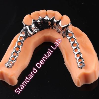 Mua In laser Cobalt Chrome Kim loại khung răng giả một phần Ni Be miễn phí sản xuất trực tuyến