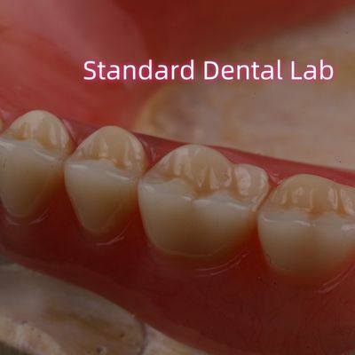 Mua SDL Nhiệt trị Acrylic răng giả một phần Ivoclar răng nha khoa phòng thí nghiệm chính xác cao sản xuất trực tuyến