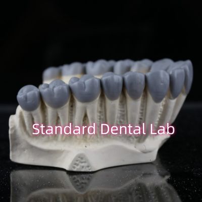 Mua SDL phòng thí nghiệm nha khoa kỹ thuật số chẩn đoán Wax Up Crown Bridge sản xuất trực tuyến