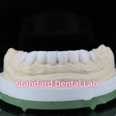 Mua Chẩn đoán nha khoa phục hồi sáp lên veneers thẩm mỹ cao sản xuất trực tuyến