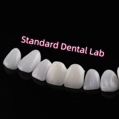 Mua Chống mài mòn Emax Zirconia Laminate Veneers Incisal Translucency sản xuất trực tuyến
