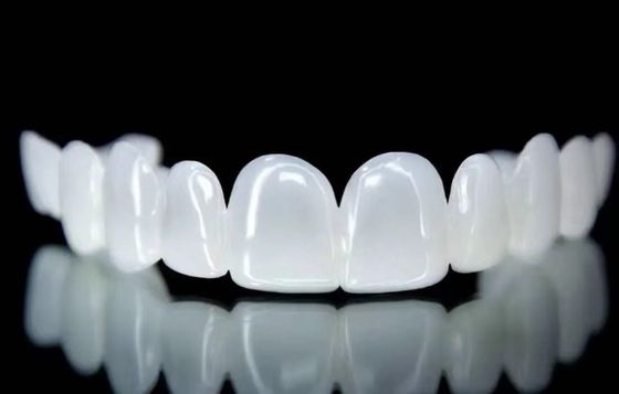 Mua Tải ra Snap On Veneers Snow White Shade Tốt phù hợp Dịch vụ thiết kế nha khoa sản xuất trực tuyến
