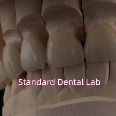 Mua Phòng thí nghiệm nha khoa chuyên nghiệp vương miện Zirconia cho phục hồi cố định sản xuất trực tuyến