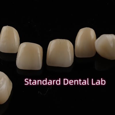 Mua Quần vương miện Zirconia lớp cứng răng hoàn toàn phục hồi vòm trên sản xuất trực tuyến