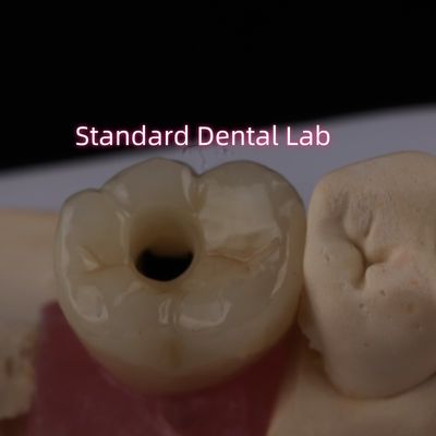 Mua Ứng dụng cấy ghép Crown Bruxier Solid Zirconia Screw sản xuất trực tuyến
