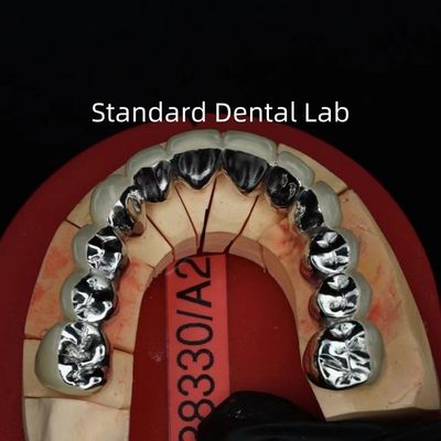 Mua Full Arch Metal Porcelain Crown / Bridge chính xác thẩm mỹ PFM Crown răng sản xuất trực tuyến