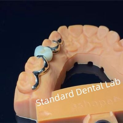 Mua Răng răng PFM Maryland Bridge thẩm mỹ cao FDA chứng nhận sản xuất trực tuyến