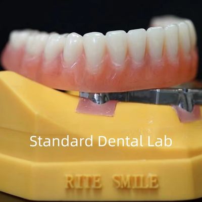 Mua Mẫu răng giả được hỗ trợ bằng cấy ghép titan Mẫu răng giả Ivoclar chính xác trên cấy ghép ISO FDA CE sản xuất trực tuyến