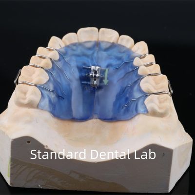 Mua Vòng vít răng miệng mở rộng miệng mở rộng vít Ortho mở rộng sản xuất trực tuyến