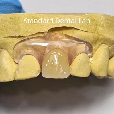 Mua Răng TCS Valplast Dental Dental Valplast Dental Valplast Dental Valplast Dental Valplast Dental Valplast Dental Valplast Dental Valplast Dental Valplast Dental Valplast Dental Valplast Dental Valplast sản xuất trực tuyến