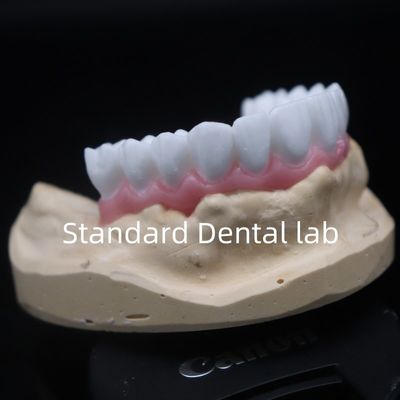 Mua Cao thẩm mỹ trắng răng vương miện chẩn đoán sáp lên tùy chỉnh Trung Quốc phòng thí nghiệm nha khoa sản xuất trực tuyến