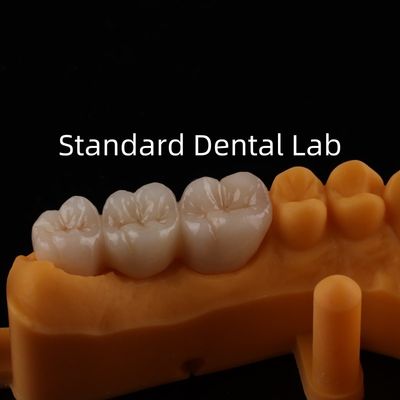 Mua Be Ni miễn phí kim loại sứ vương miện chính xác thẩm mỹ PFM vương miện răng sản xuất trực tuyến
