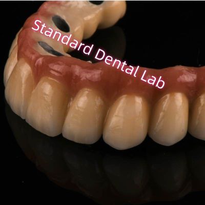 Mua Cobalt Chrome Ivoclar Laser Sintered PFM Crown Metal Porcelain Bridge A1 A2 A3 sản xuất trực tuyến