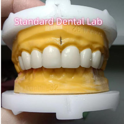 Mua Ivoclar Zirconia Crown Veneers Độ xuyên suốt cao sản xuất trực tuyến
