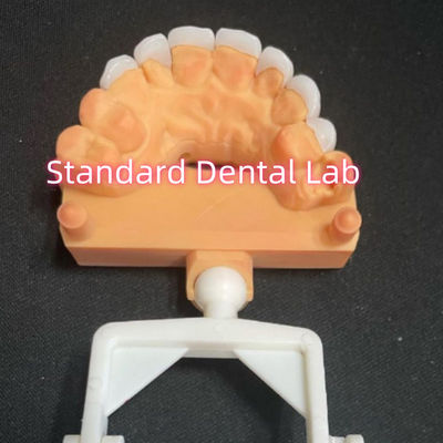 Mua Loại sợi lợp Zirconia Emax Thickness 0.6mm sản xuất trực tuyến