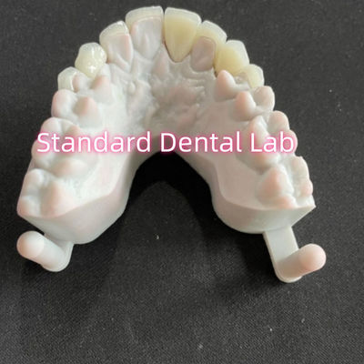 Mua Stars' Smile Dental Teeth Emax Zirconia Laminate Veneers 0.6mm sản xuất trực tuyến