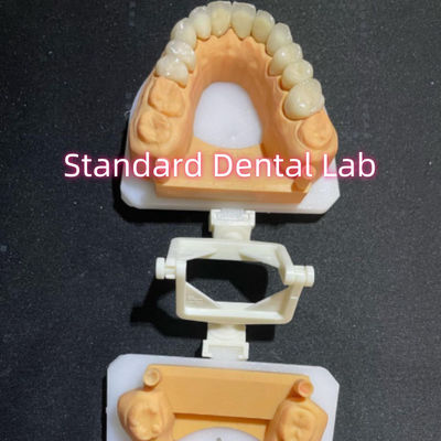 Mua Nha khoa phục hồi nha khoa chăm sóc răng miệng toàn bộ vương miện Zirconia tùy chỉnh sản xuất trực tuyến
