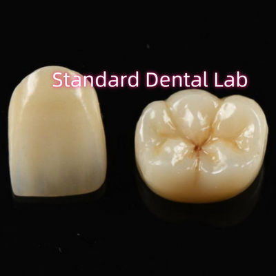 Mua Biocompatible vật liệu thẩm mỹ Zirconia vương miện Zirconia cầu răng sản xuất trực tuyến