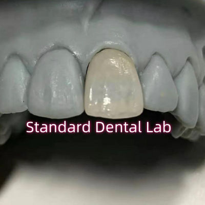 Mua Nha khoa phục hồi Emax Vương miện sứ Zirconia nha khoa sản xuất trực tuyến