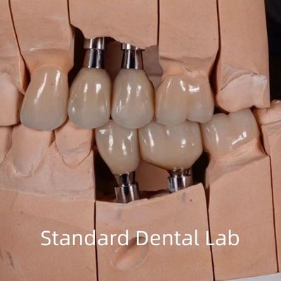 Mua Đồ cấy ghép vòng tròn Zirconia được giữ lại sản xuất trực tuyến