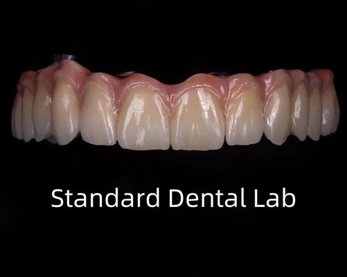 Mua Titanium đầy đủ Zirconia cầu răng xuyên suốt trên thanh cấy ghép sản xuất trực tuyến