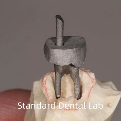 Mua Quá trình phục hồi răng kim loại và hạt nhân vương miện hoàn hảo sản xuất trực tuyến
