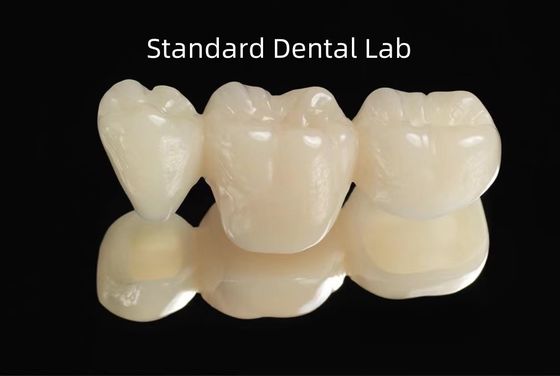 Mua CAD CAM trống PMMA tạm thời răng tạm thời cầu sản xuất trực tuyến