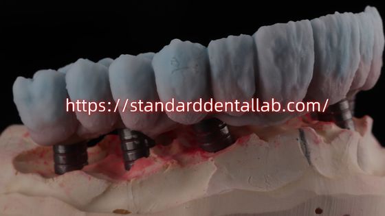 Mua Cây cầu Zirconia được hỗ trợ bằng cấy ghép với vỏ Titan có tính thẩm mỹ cao sản xuất trực tuyến