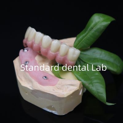 Mua Được vặn tất cả trên 6 toàn bộ Zirconia cầu nha khoa chính xác cao trên Ti cơ sở sản xuất trực tuyến