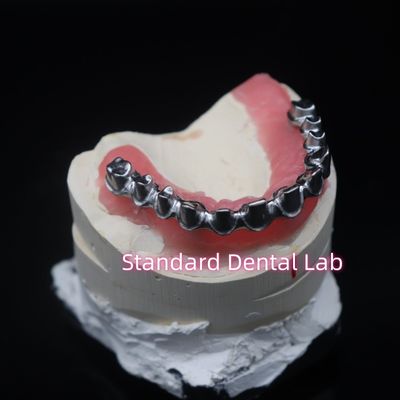 Mua Full Arch Malo Bridge Phục hồi răng Circonia Vương miện với kẹo cao su Poecelian Trung Quốc Phòng thí nghiệm nha khoa sản xuất trực tuyến