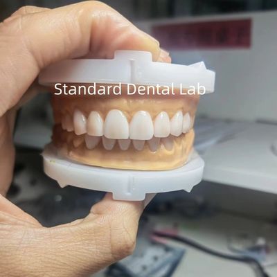 Mua Perfect Esthetics Wax tạm thời cho các chuyên gia nha khoa sử dụng sáp nha khoa từ Trung Quốc Dental Lab sản xuất trực tuyến