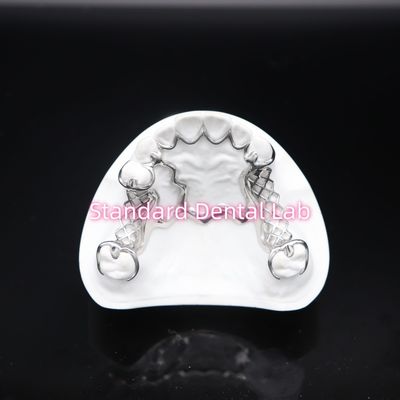 Mua in Scheftner kim loại phần răng giả khung chính xác tùy chỉnh đúc phần răng giả sản xuất trực tuyến