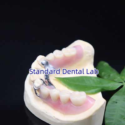 Mua Acrylic kim loại phần răng giả khung thẩm mỹ cao SDL phòng thí nghiệm nha khoa sản xuất trực tuyến
