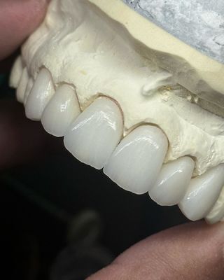 Mua Vương miện Zirconia lớp xuyên suốt cho chức năng tối ưu và thẩm mỹ tự nhiên sản xuất trực tuyến
