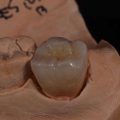 Mua Vương miện Zirconia xuyên suốt có đường viền đầy đủ để mang lại kết quả đẹp mắt sản xuất trực tuyến
