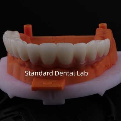 Mua Tốt phù hợp chính xác thẩm mỹ Zirconia Porcelain Crown Pink Porcelain với màu trắng sản xuất trực tuyến