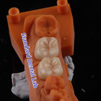 Mua Full Contour Zirconia vương miện xuyên suốt 3D PRO Không lớp phủ sứ Phòng thí nghiệm nha khoa tiêu chuẩn sản xuất trực tuyến