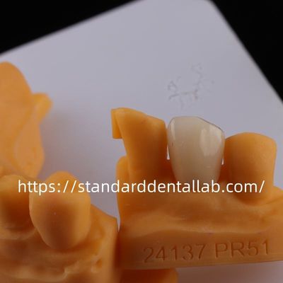 Mua Full Contour phòng thí nghiệm nha khoa vương miện cao xuyên suốt Solid Zirconia Crown Trung Quốc phòng thí nghiệm nha khoa sản xuất trực tuyến